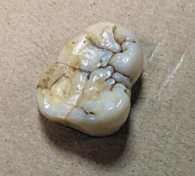 Zahn eines Gigantopithecus